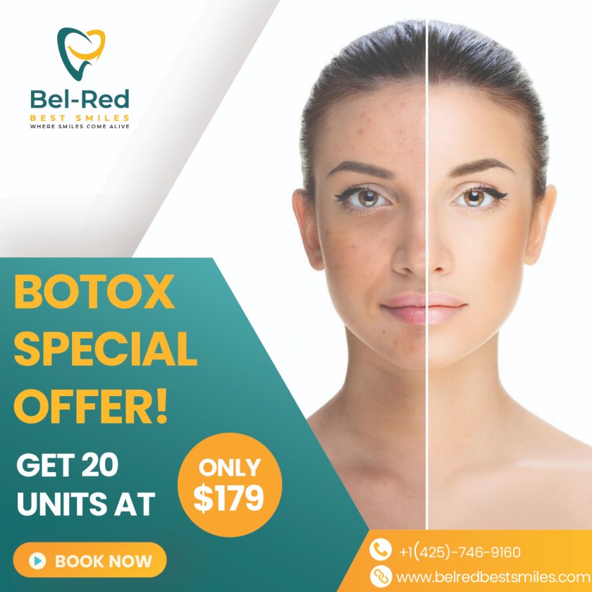 Bel-Red best Smiles-Botox