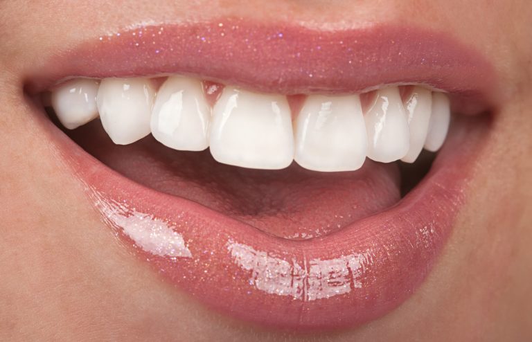 Dentist Unless - BelRed Best Smiles